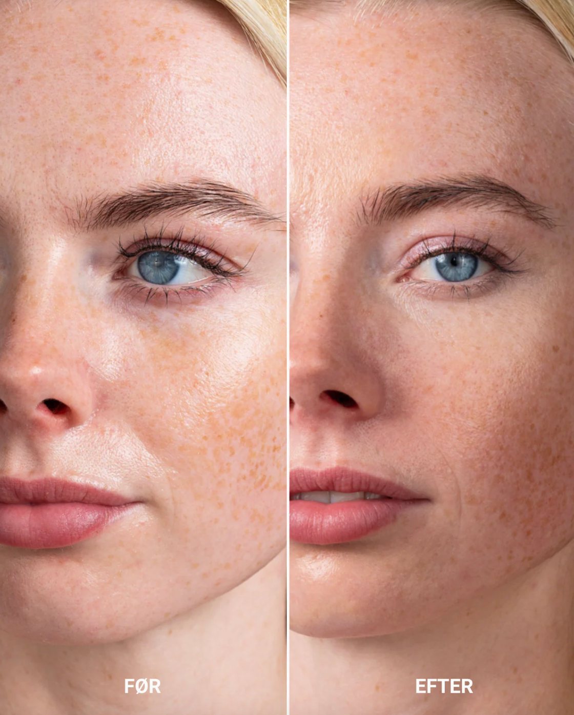 Perfecting Concealer - Light Neutral Cool Rosy
